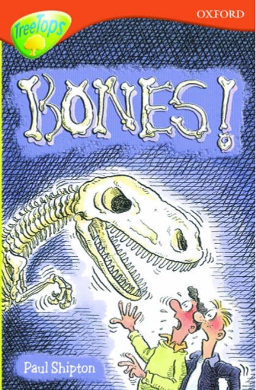 Bones!