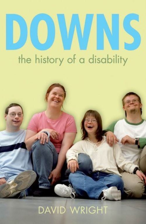 Down's
