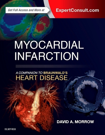 Myocardial Infarction