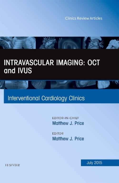 Intravascular Imaging