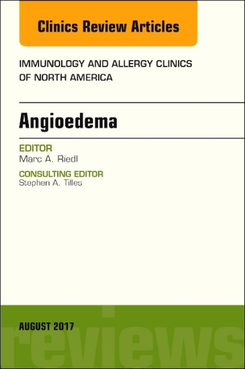 Angioedema