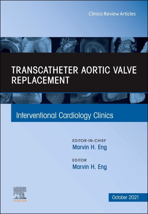Transcatheter Aortic Valve Replacement