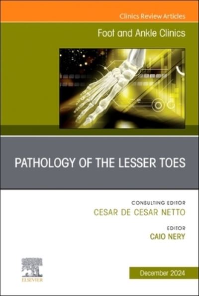 Pathology of the Lesser Toes, An Issue of Foot and Ankle Clinics of North America