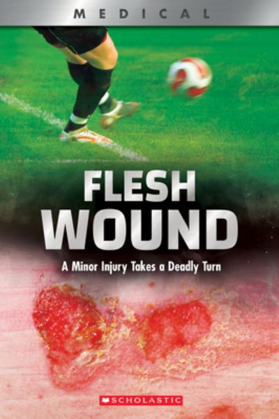 Flesh Wound