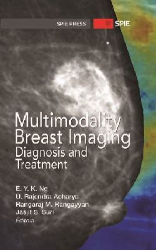 Multimodality Breast Imaging