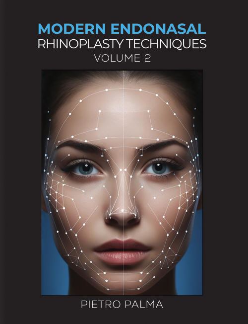 Modern Endonasal Rhinoplasty Techniques. Volume 2