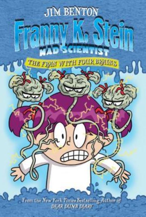 The Fran With Four Brains
