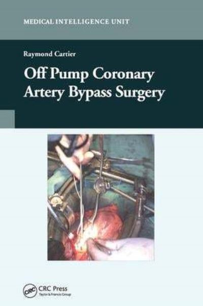 Off Pump Coronary Artery Bypass Surgery
