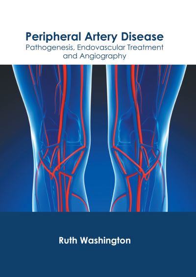 Peripheral Artery Disease