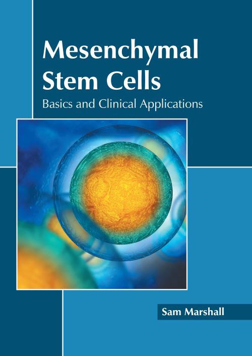 Mesenchymal Stem Cells