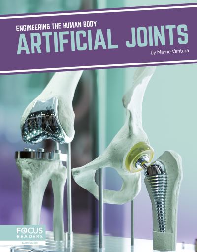 Artificial Joints. Paperback