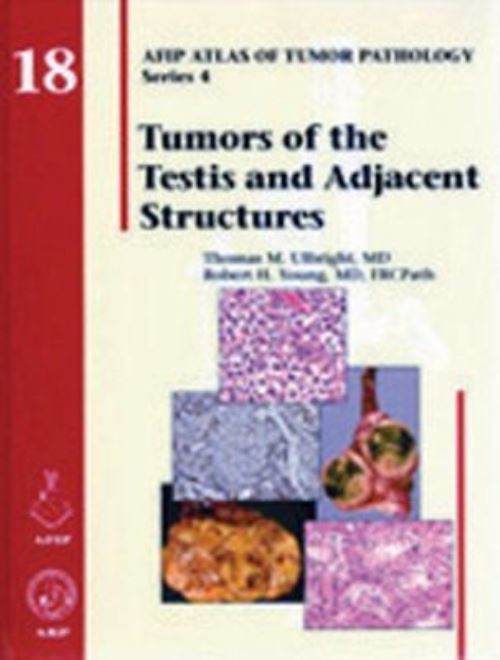 Tumors of the Testis and Adjacent Structures