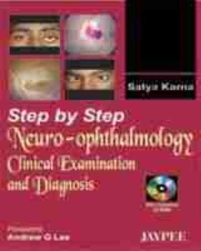 Step by Step¬ Neuro-Ophthalmology
