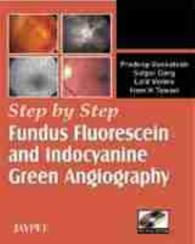Step by Step® Fundus Fluorescein and Indocyanine Green Angiography