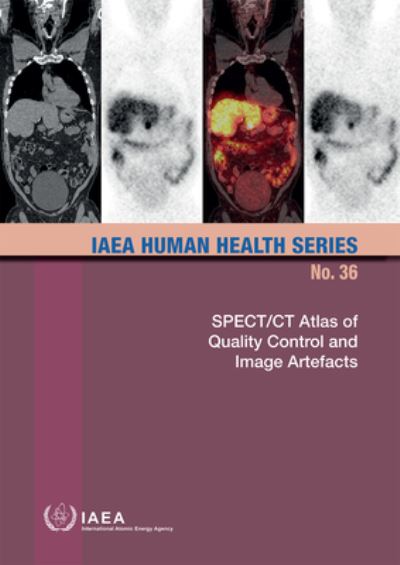 SPECT/CT Atlas of Quality Control and Image Artefacts