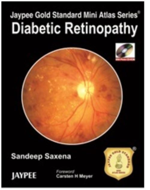Diabetic Retinopathy