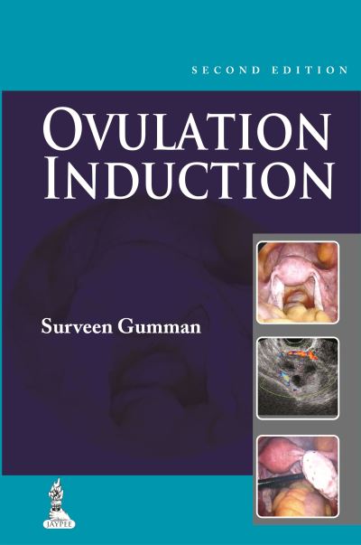 Step by Step Ovulation Induction