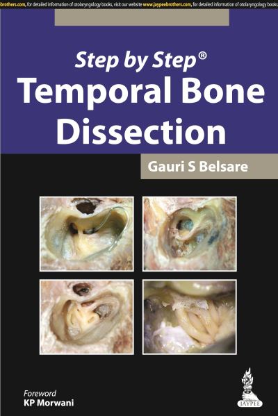 Step by Step Temporal Bone Dissection