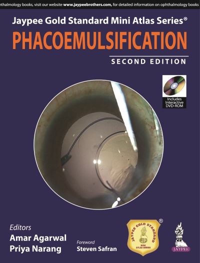 Phacoemulsification
