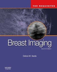 Book Cover for Breast Imaging by Debra M Ikeda