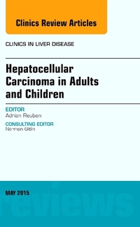 Book Cover for Hepatocellular Carcinoma in Adults and Children by Adrian Reuben