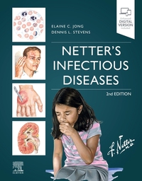 Book Cover for Netter's Infectious Diseases by Elaine C Jong, Dennis L Stevens, Frank H Netter, Carlos A G Machado