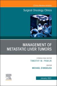 Book Cover for Management of Metastatic Liver Tumors by Michael DAngelica
