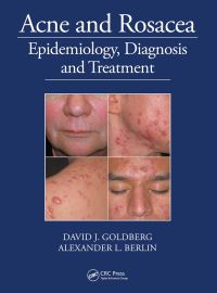 Book Cover for Acne and Rosacea by David J Goldberg, Alexander L Berlin