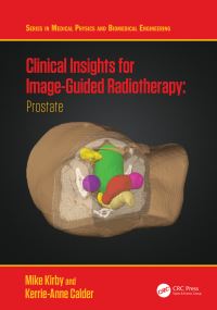 Book Cover for Clinical Insights for Image-Guided Radiotherapy by Mike Kirby, KerrieAnne Calder