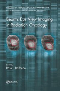 Book Cover for Beam's Eye View Imaging in Radiation Oncology by Ross I Berbeco