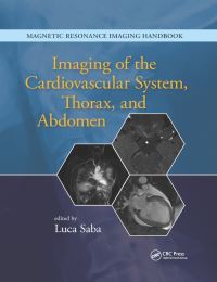 Book Cover for Imaging of the Cardiovascular System, Thorax, and Abdomen by Luca Saba