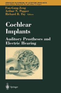 Book Cover for Cochlear Implants by FanGang Zeng, Arthur N Popper, Richard R Fay