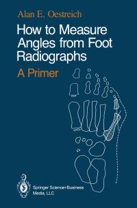 Book Cover for How to Measure Angles from Foot Radiographs by Alan E Oestreich