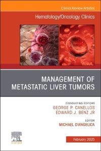 Book Cover for Management of Metastatic Liver Tumors by Michael DAngelica