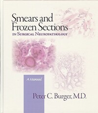 Book Cover for Smears & Frozen Sections in Surgical Neuropathology by Peter Burger
