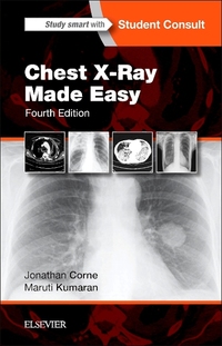 Book Cover for Chest X-Ray Made Easy by Jonathan Corne, Maruti Kumaran