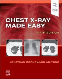 Book Cover for Chest X-Ray Made Easy by Jonathan Corne, Iain Au-Yong, Jonathan Corne