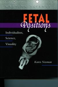 Book Cover for Fetal Positions by Karen Newman