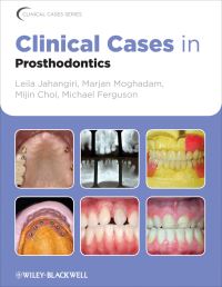 Book Cover for Clinical Cases in Prosthodontics by Leila Jahangiri