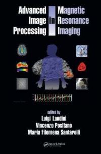 Book Cover for Advanced Image Processing in Magnetic Resonance Imaging by Luigi Landini, Vicenzo Positano, Maria Filomena Santarelli