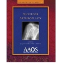 Book Cover for Shoulder Arthroplasty by Joaquin SanchezSotelo