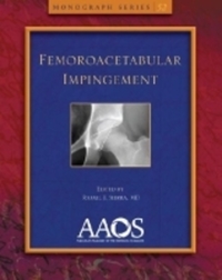 Book Cover for Femoroacetabular Impingement by Rafael J Sierra