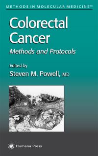 Book Cover for Colorectal Cancer by Steven M Powell