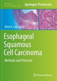 Book Cover for Esophageal Squamous Cell Carcinoma by Alfred K Lam