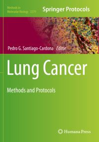 Book Cover for Lung Cancer by Pedro G SantiagoCardona