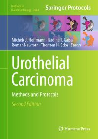 Book Cover for Urothelial Carcinoma by Michèle J Hoffmann, Nadine T Gaisa, Roman Nawroth, Thorsten Holger Ecke