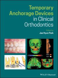 Book Cover for Temporary Anchorage Devices in Clinical Orthodontics by Jae Hyun Park