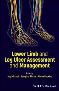 Book Cover for Lower Limb and Leg Ulcer Assessment and Management by Aby Mitchell, Georgina Ritchie, Alison Hopkins