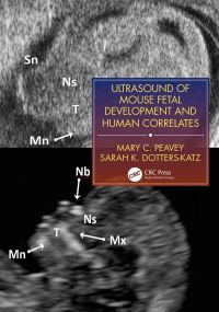 Book Cover for Ultrasound of Mouse Fetal Development and Human Correlates by Mary C Peavey, Sarah K DottersKatz