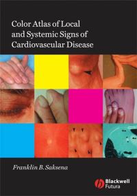 Book Cover for Color Atlas of Local and Systemic Signs of Cardiovascular Disease by Franklin B Saksena